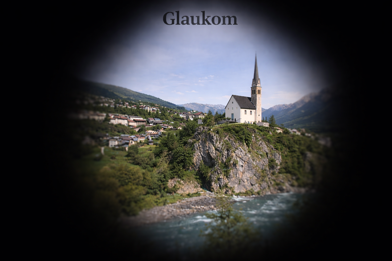 Seh-Simulation bei Glaukom