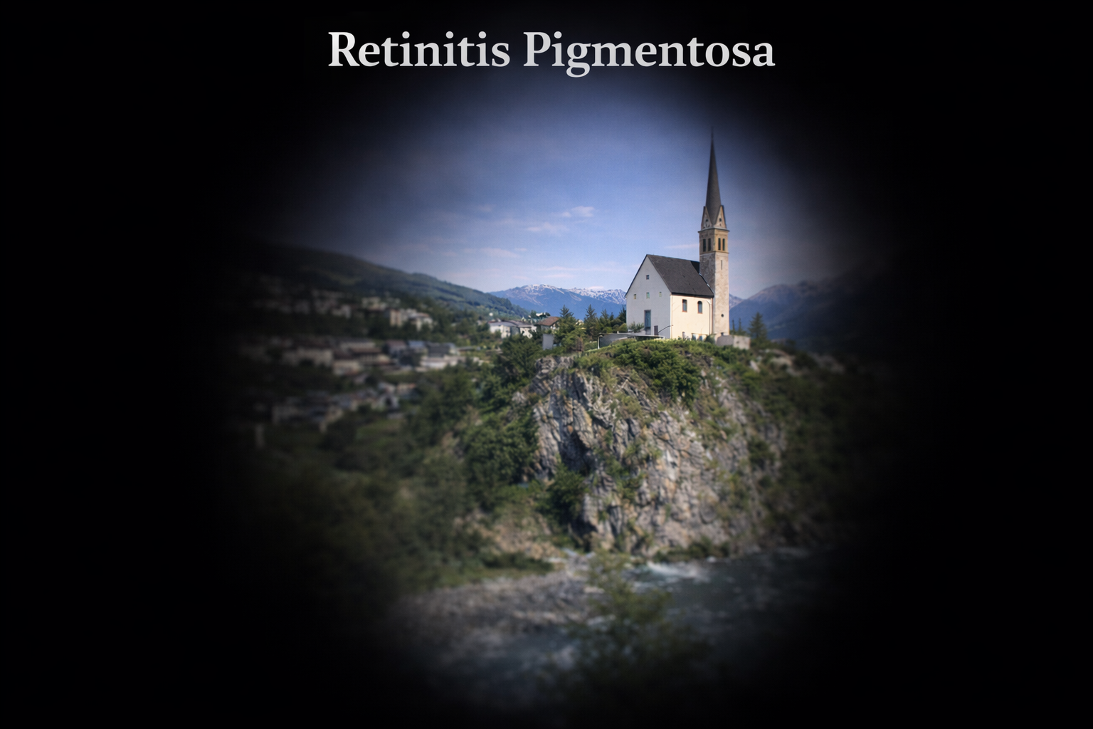 Seh-Simulation bei Retinitis Pigmentosa