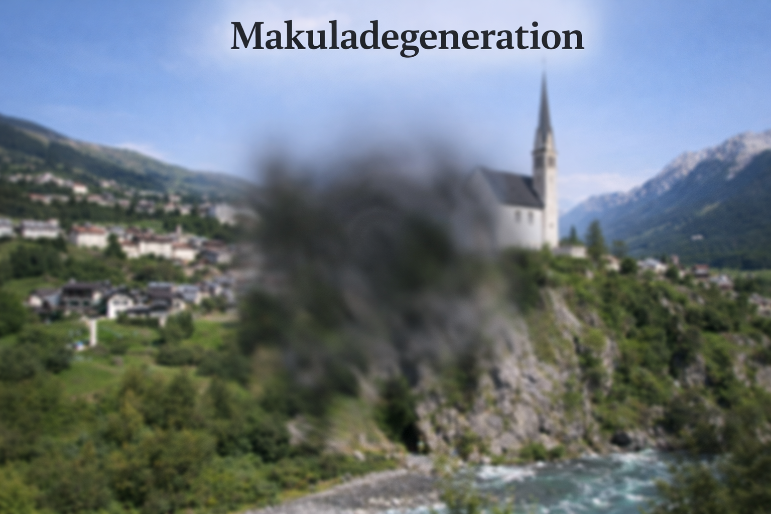 Seh-Simulation bei Makuladegeneration