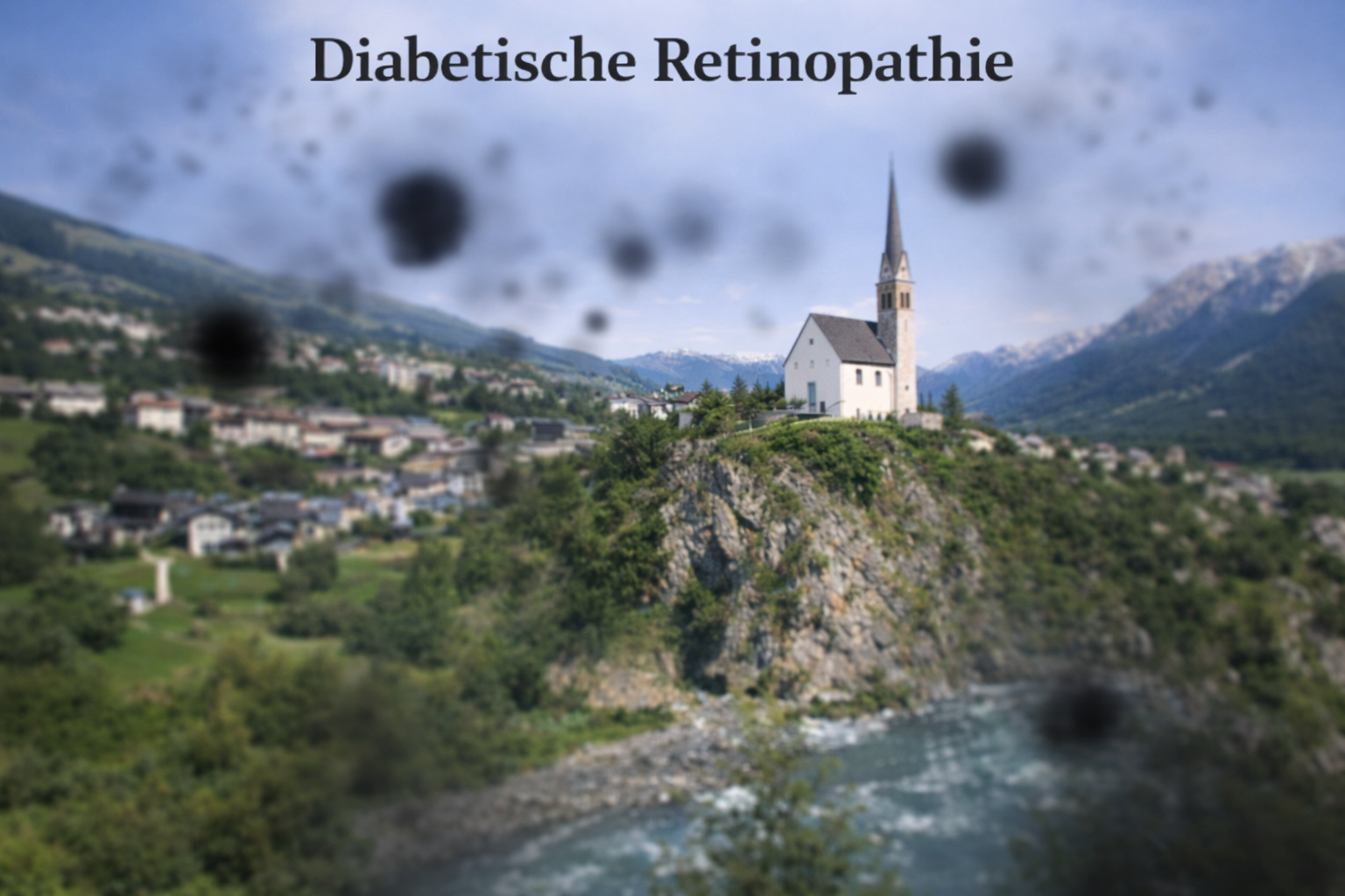 Seh-Simulation bei diabetischer Retinopathie
